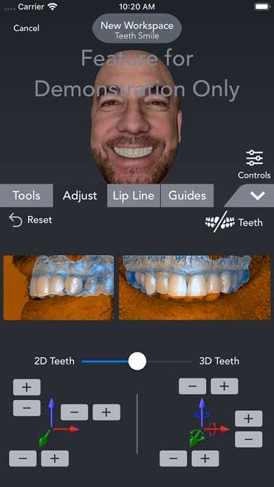 Bellus3D Dental Pro精简版